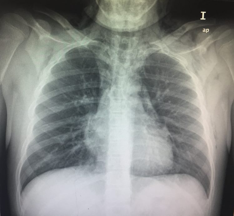 Cuál es su diagnóstico?