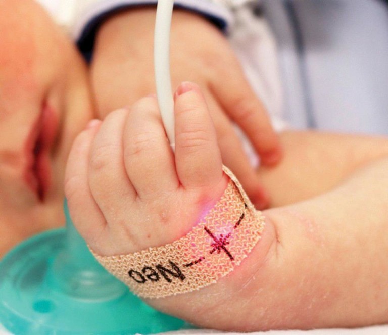 Tamiz cardiaco neonatal