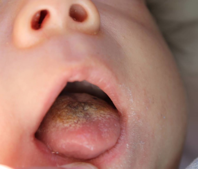 Cuál es su diagnóstico?