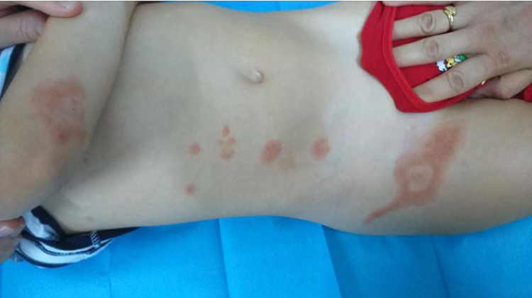 Cuál es tu diagnóstico?