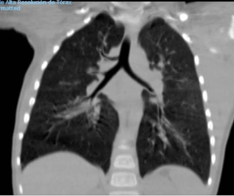 Cuál es tu diagnóstico?