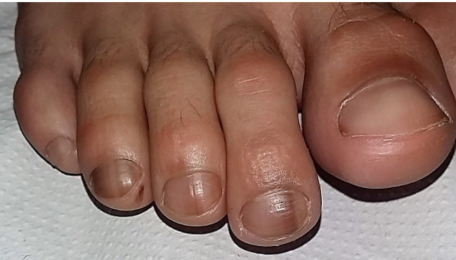 Cuál es tu dignóstico?