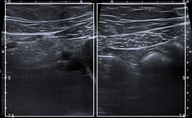 Cuál es tu diagnóstico?