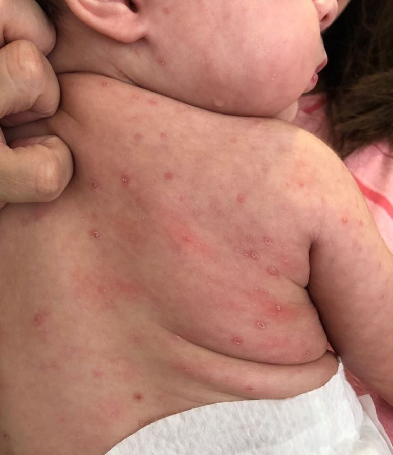 Cuál es tu diagnóstico?