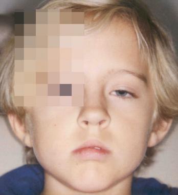 Cuál es tu diagnóstico?