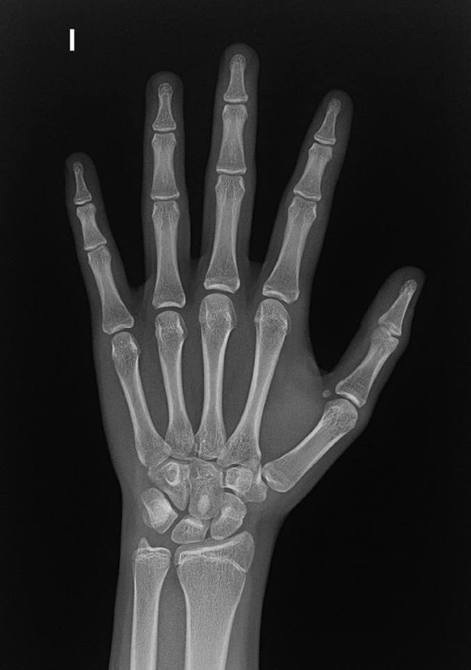 Cuál es tu diagnóstico?